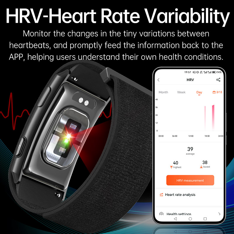 VWAR Loop X ECG Smart Bracelet - Xbody Health & Wellness Functional Integrative Medicine Office & Medical Spa Photos review and price